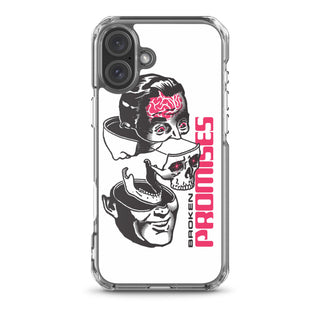 Brain Surgery iPhone Case