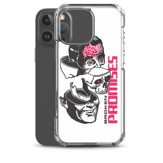 Brain Surgery iPhone Case