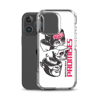 Brain Surgery iPhone Case