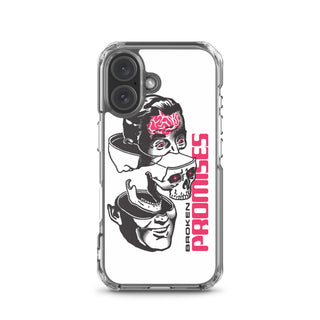 Brain Surgery iPhone Case