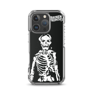 Death Stare iPhone Case