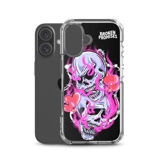 Gets Hurt iPhone Case