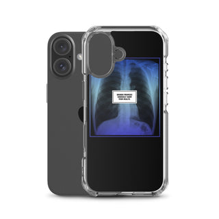 Hazardous iPhone Case